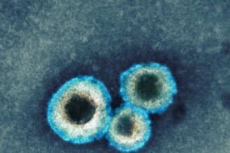 What Is Human Metapneumovirus, and Why Are Cases Rising in China?