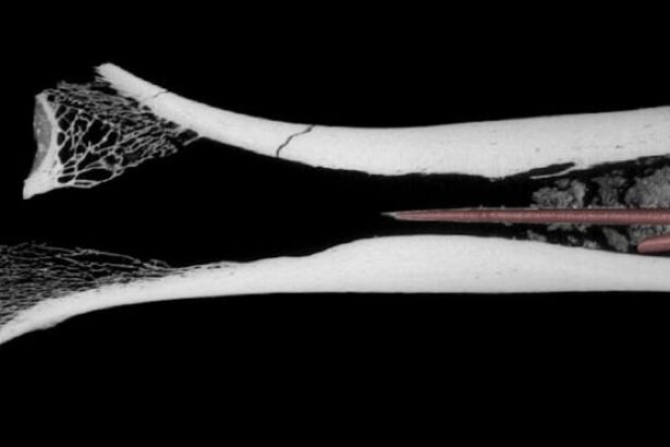 World’s Oldest Arrow Poison Found in Ancient Bone From 7,000 Years Ago : ScienceAlert