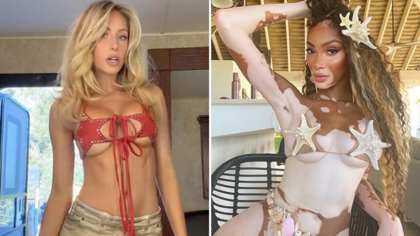 Alix Earle vs. Winnie Harlow Who’d You Rather?!