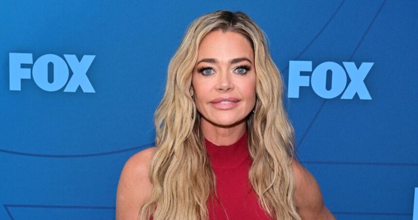 Denise Richards Tried Salmon Sperm Facial Because of Jennifer Aniston