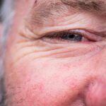 ‘Good’ cholesterol may be linked to heightened glaucoma risk among over 55s