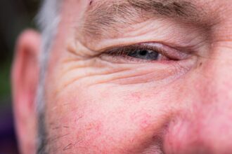 ‘Good’ cholesterol may be linked to heightened glaucoma risk among over 55s