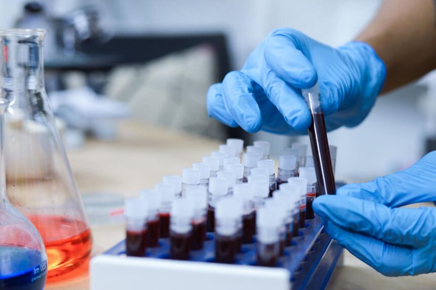 New Blood Test Could Detect Pancreatic Cancer Earlier