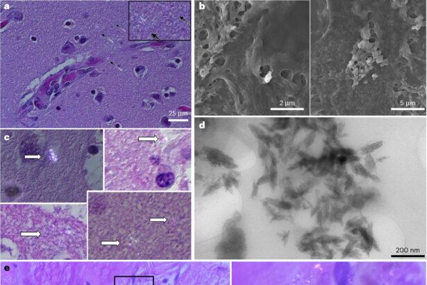 Scientists find more microplastics in human brains than in kidneys and livers—and levels are rising
