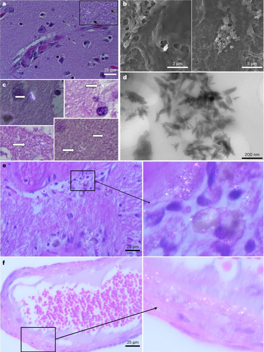 Scientists find more microplastics in human brains than in kidneys and livers—and levels are rising