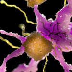 Who is benefiting from the amyloid hypothesis of Alzheimer’s?