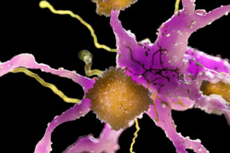 Who is benefiting from the amyloid hypothesis of Alzheimer’s?