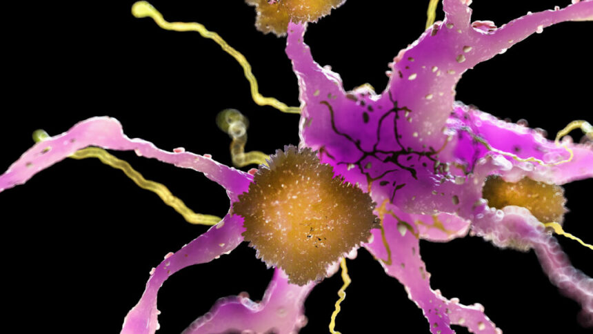 Who is benefiting from the amyloid hypothesis of Alzheimer’s?