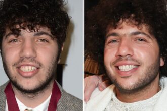 Benny Blanco — Good Genes or Good Docs?!