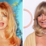 Did Goldie Hawn Have Plastic Surgery? What She Has Said About Aging