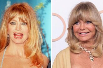 Did Goldie Hawn Have Plastic Surgery? What She Has Said About Aging