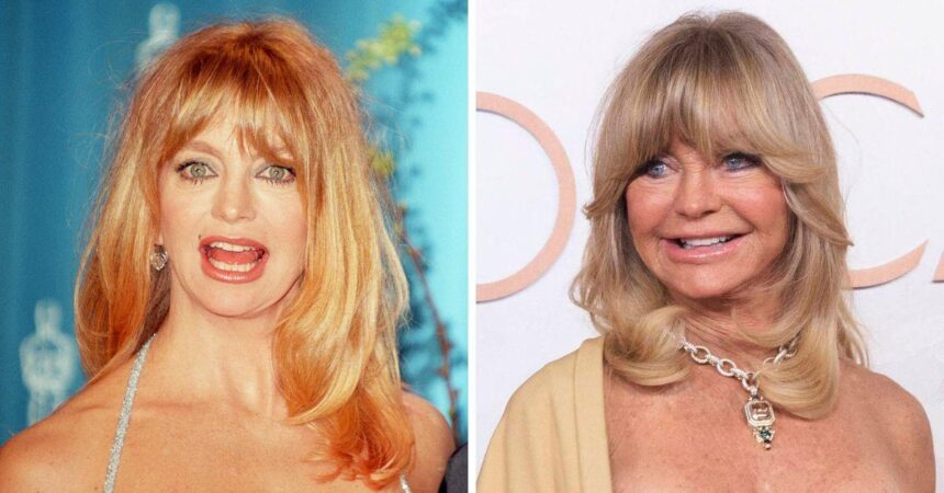 Did Goldie Hawn Have Plastic Surgery? What She Has Said About Aging