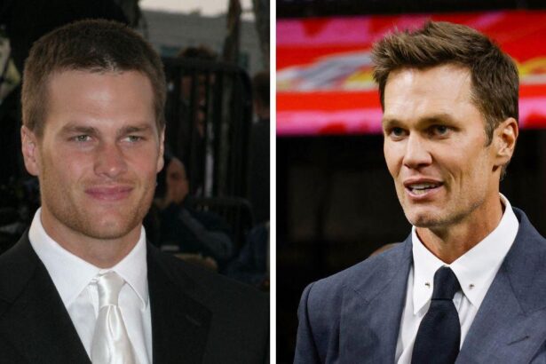 Did Tom Brady Get Plastic Surgery? Inside The Rumors
