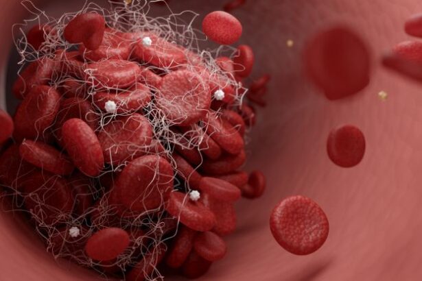 Expert Reveals 8 ‘Essential’ Ways to Reduce Your Risk of Stroke : ScienceAlert