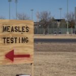 Measles Cases Surpass 300 In Texas, New Mexico: Here’s What You Should Know