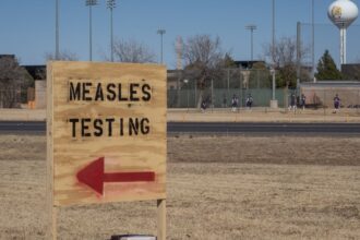 Measles Cases Surpass 300 In Texas, New Mexico: Here’s What You Should Know