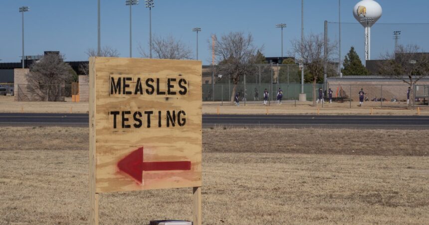 Measles Cases Surpass 300 In Texas, New Mexico: Here’s What You Should Know