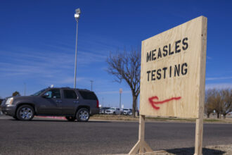 Measles outbreak likely larger than reported, experts say