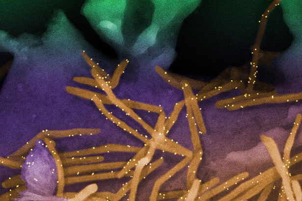 Understanding how ENSO cycles impact immunity and outbreak patterns
