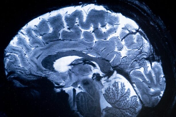 Brain Structure That Filters Consciousness Identified