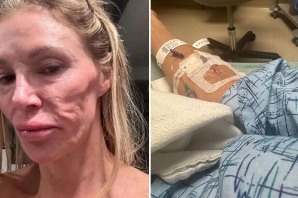 Brandi Glanville Rushed To Hospital Amid ‘Parasite’ Facial Battle