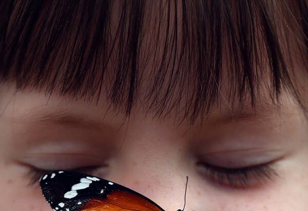 Breakthrough Gene Therapy For Butterfly Children’s Disease