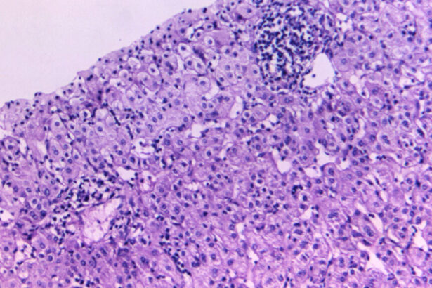 ACIP hep b vaccine, FDA drug vouchers: Morning Rounds