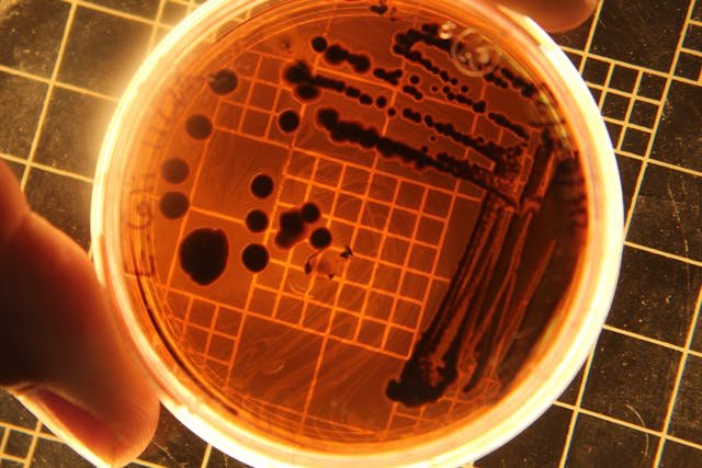 Can You File A Salmonella Claim Without Legal Assistance?