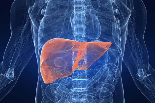 Drugs like Wegovy can be effective at treating fatty liver disease