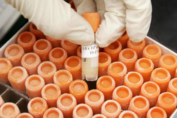 Early Parkinson’s trials revive stem cells as a possible treatment