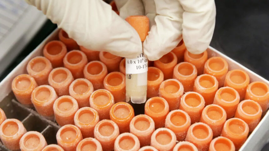 Early Parkinson’s trials revive stem cells as a possible treatment