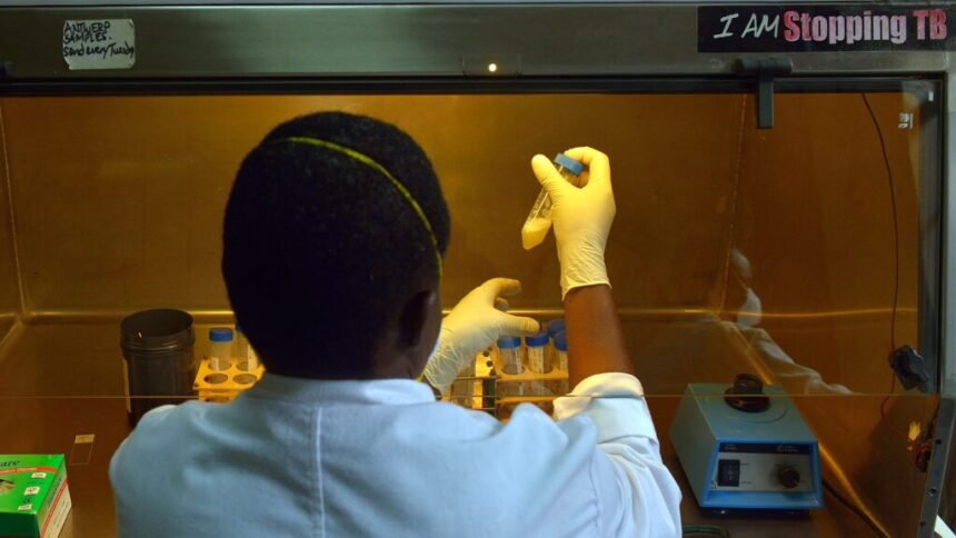 Major tuberculosis vaccine trial finishes enrollment faster than expected