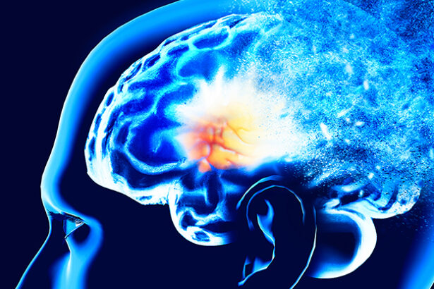 Massive Study Links 15 Factors to Early Dementia Risk : ScienceAlert