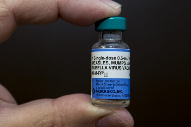 Measles in Texas, CDC’s STI lab, migration