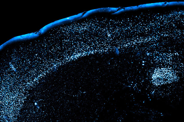 Mouse brains hint at why it’s so hard to forget food poisoning