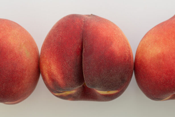 Nobody Likes to Talk About Anal Cancer. Here’s Why You Should. : ScienceAlert