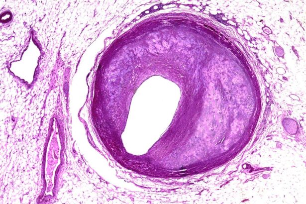 One-off gene-editing therapy could permanently lower cholesterol