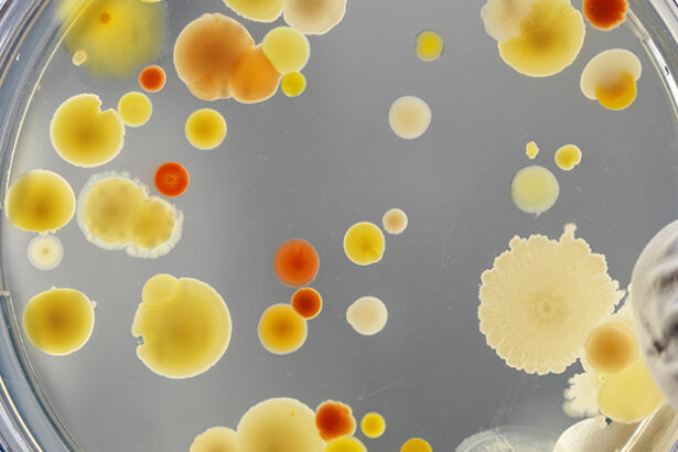 Oxygen Metabolism Emerged on Earth Before The Great Oxidation Event, Study Reveals : ScienceAlert