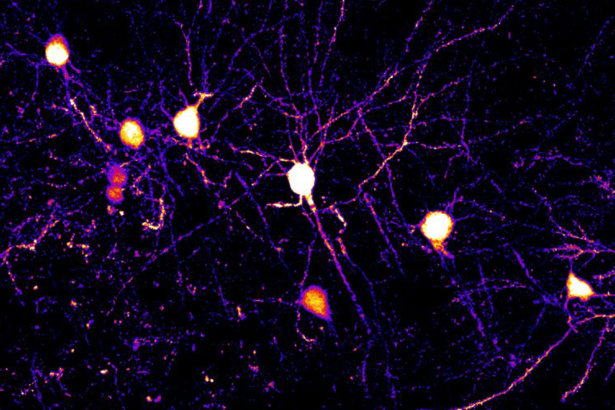 Scientists watch how mice learn, one synapse at a time