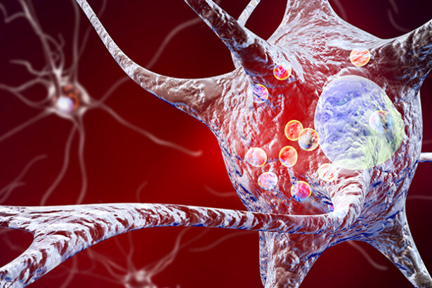 Smart Brain Implants Can Now Adapt to Optimize Parkinson’s Treatment : ScienceAlert