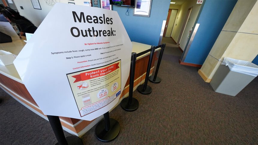 The U.S. measles outbreak shows no signs of slowing