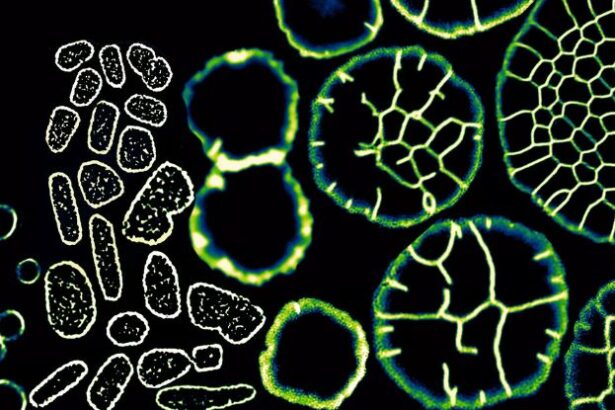 This Single-Celled Microbe Can Transform Into a Multicellular Creature : ScienceAlert