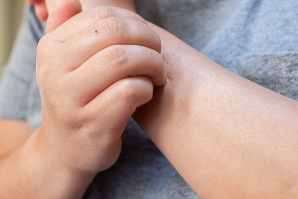 Your skin is crawling with zombie cells–some help, some hurt