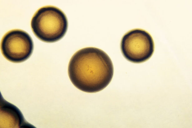 gonorrhea treatment, CT scans and cancer, NIH