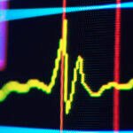 A Hidden Pattern in Your Pulse Could Signal Future Cognitive Decline : ScienceAlert