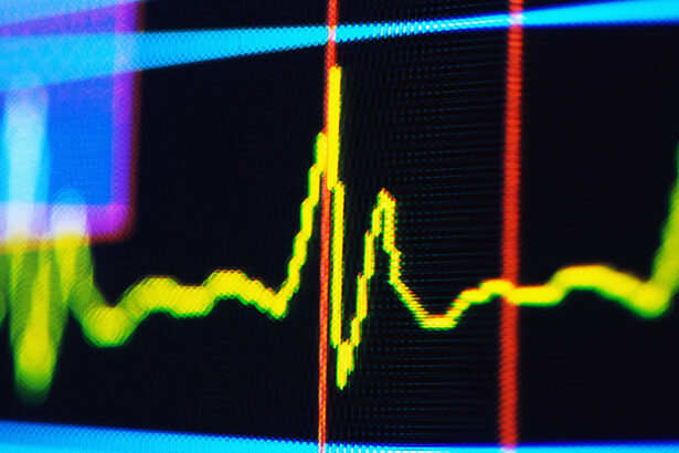 A Hidden Pattern in Your Pulse Could Signal Future Cognitive Decline : ScienceAlert