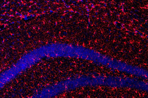 A protein that promotes healthy aging and improves longevity