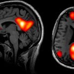 Being Bored Could Actually Be Good For Your Brain, Scientists Reveal : ScienceAlert