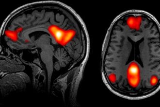 Being Bored Could Actually Be Good For Your Brain, Scientists Reveal : ScienceAlert