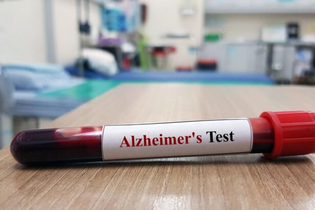 Breakthrough Alzheimer’s Blood Test Explained By Neurologists